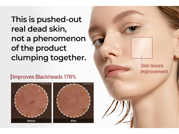 DR.MELAXIN PEEL SHOT LINE Delikatnie złuszczająca ampułka z ekstraktem z czarnego ryżu 80 ml #6